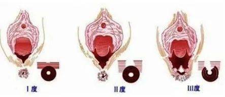 处破女处破全过程,无痛感无损伤